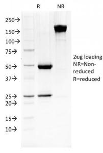 SDS-PAGE analysis of Anti-HSP27 Antibody [G3.1] under non-reduced and reduced conditions; showing intact IgG and intact heavy and light chains, respectively. SDS-PAGE analysis confirms the integrity and purity of the Antibody