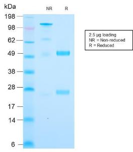 SDS-PAGE analysis of Anti-Cytochrome C Antibody [CYCS/3128R] under non-reduced and reduced conditions; showing intact IgG and intact heavy and light chains, respectively SDS-PAGE analysis confirms the integrity and purity of the antibody