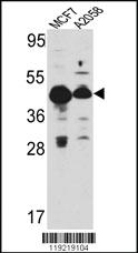 Anti-TGIF1 Rabbit Polyclonal Antibody