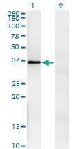 Anti-FRZB Mouse Monoclonal Antibody [clone: 3C3]