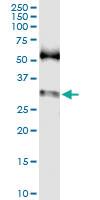 Anti-SNAI1 Polyclonal Antibody Pair