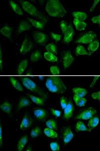 Immunofluorescence analysis of HepG2 cells using Anti-KIR2DL3 Antibody (A8958). DAPI was used to stain the cell nuclei (blue)