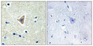 Immunohistochemical analysis of paraffin-embedded human brain tissue using Anti-CDH20 Antibody. The right hand panel represents a negative control, where the antibody was pre-incubated with the immunising peptide