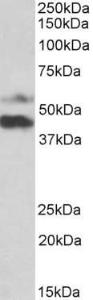 Anti-PYROXD1 Antibody (A85088) (1µg/ml) staining of Human Colorectal cancer lysate (35µg protein in RIPA buffer). Primary incubation was 1 hour. Detected by chemiluminescence.