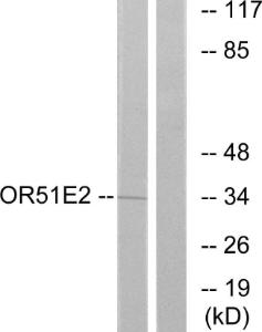 Western blot analysis of lysates from Jurkat cells using Anti-OR51E2 Antibody. The right hand lane represents a negative control, where the antibody is blocked by the immunising peptide