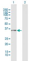 Anti-GLB1L3 Mouse Polyclonal Antibody