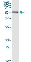 Anti-PSMD5 Polyclonal Antibody Pair