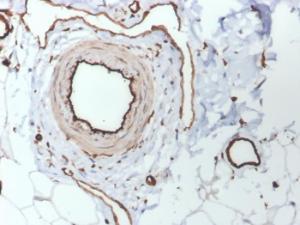 Immunohistochemical analysis of formalin-fixed, paraffin-embedded human skin using Anti-CD31 Antibody [PECAM1/3530]