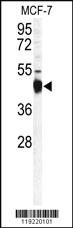 Anti-GLB1 Rabbit Polyclonal Antibody