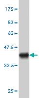 Anti-EXOC7 Mouse Monoclonal Antibody [clone: 1D4]