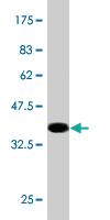 Anti-AMFR Mouse Monoclonal Antibody [clone: 3D9]