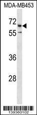 Anti-CATSPER2 Rabbit Polyclonal Antibody (FITC (Fluorescein Isothiocyanate))