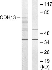 Antibody anti-CDH13 A95915-100 100 µg