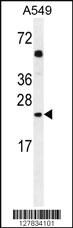 Anti-GOLGA2P5 Rabbit Polyclonal Antibody