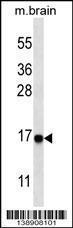 Anti-MAP1LC3A Rabbit Polyclonal Antibody (AP (Alkaline Phosphatase))