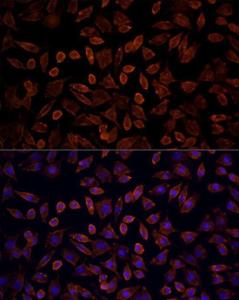 Immunofluorescence analysis of L929 cells using Anti-KRAS Antibody (A93164) at dilution of 100 (40X lens). DAPI was used to stain the cell nuclei (blue)