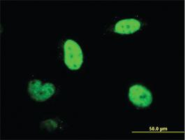 Anti-SNUPN Mouse Monoclonal Antibody [clone: 2B2-1B4]