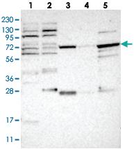 Anti-NUDCD1 Rabbit Polyclonal Antibody