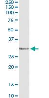 Anti-EPCR Antibody Pair