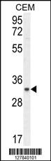 Anti-C11orf74 Rabbit Polyclonal Antibody