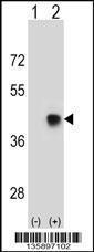 Anti-SPEM1 Rabbit Polyclonal Antibody