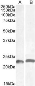 Anti-LIF Antibody (A85090) (0.5µg/ml) staining of Mouse (A) and (1µg/ml) Rat (B) Colon lysate (35µg protein in RIPA buffer). Detected by chemiluminescence.