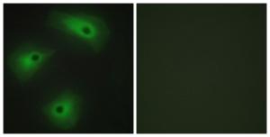 Immunofluorescence analysis of HeLa cells using Anti-TM16A Antibody. The right hand panel represents a negative control, where the antibody was pre-incubated with the immunising peptide