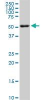 Anti-AKT2 Mouse Monoclonal Antibody [clone: 1F8]