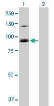 Anti-SFMBT1 Rabbit Polyclonal Antibody