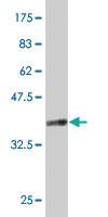 Anti-CD68 Mouse Polyclonal Antibody