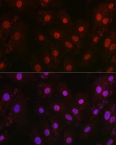 Anti-HIF1 beta antibody