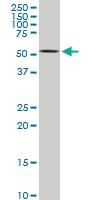 Anti-AKT2 Mouse Monoclonal Antibody [clone: 1F8]