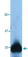 Anti-GFP Polyclonal Antibody