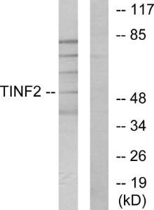 Anti-Tin2 Rabbit Polyclonal Antibody