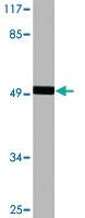 Anti-F2R Rabbit Polyclonal Antibody