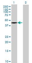 Anti-ADHFE1 Mouse Polyclonal Antibody