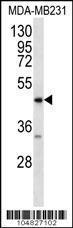 Anti-AGER Rabbit Polyclonal Antibody (APC (Allophycocyanin))