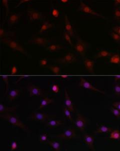 Anti-HIF1 beta antibody