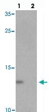 Anti-YPEL5 Rabbit Polyclonal Antibody