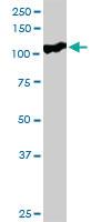 Anti-SFMBT1 Rabbit Polyclonal Antibody