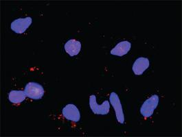 Anti-MAPK14 + MAP3K7IP1 Antibody Pair