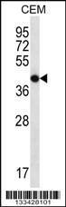 Anti-OR7G2 Rabbit Polyclonal Antibody (Biotin)