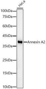 Western blot analysis of HeLa, using Anti-Annexin-2 / ANXA2 Antibody [ARC59617] (A307878) at 1:2,000 dilution. The secondary antibody was Goat Anti-Rabbit IgG H&L Antibody (HRP) at 1:10,000 dilution.