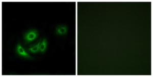 Immunofluorescence analysis of A549 cells using Anti-MRPL11 Antibody. The right hand panel represents a negative control, where the antibody was pre-incubated with the immunising peptide