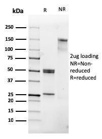 SDS-PAGE analysis of Anti-CD31 Antibody [PECAM1/3530] under non-reduced and reduced conditions; showing intact IgG and intact heavy and light chains, respectively. SDS-PAGE analysis confirms the integrity and purity of the antibody.