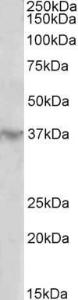 Antibody anti-HOXD12 100 µg