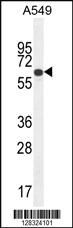 Anti-ZNF324B Rabbit Polyclonal Antibody