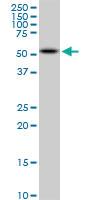 Anti-AKT2 Mouse Monoclonal Antibody [clone: 1F8]