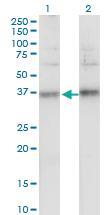 Anti-TSPAN32 Mouse Monoclonal Antibody [clone: 2B4]