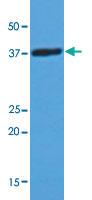 Anti-LDHA Mouse Monoclonal Antibody [clone: AT1A4]